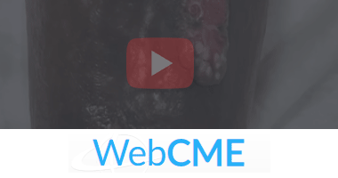 WebCME