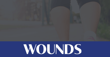 Wounds