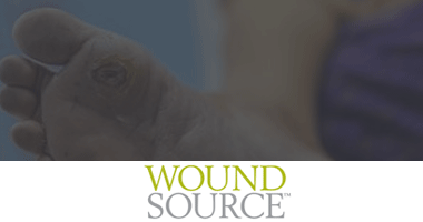 Wound Source