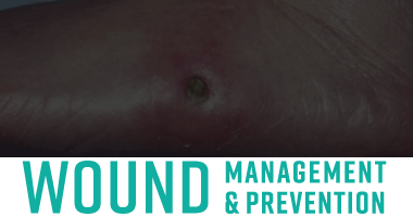 Wound Management and Prevention