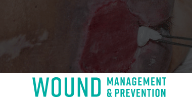 Wound Management and Prevention